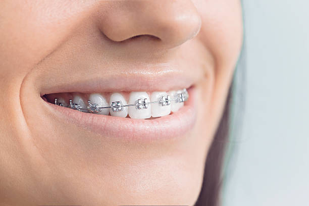 Best Tooth Extraction  in Whitehouse, OH